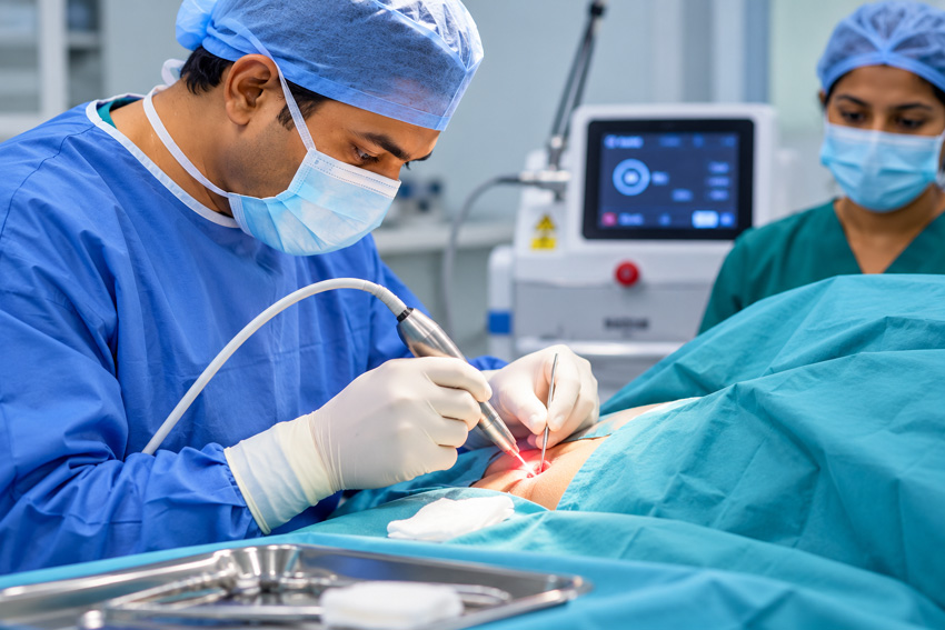 Laser Surgery